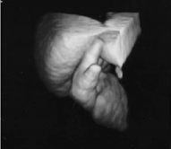3D Full Term Baby Ultrasound Phantom ATS 3DFB Hands
