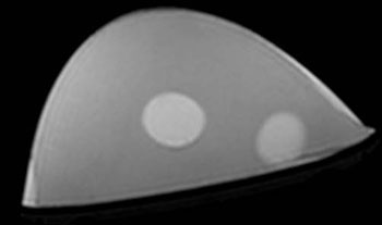 Breast Biopsy Multi-Modality Phantom - MRI Image 2