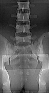 Lumbar Training Phantom CIRS 034 X-ray
