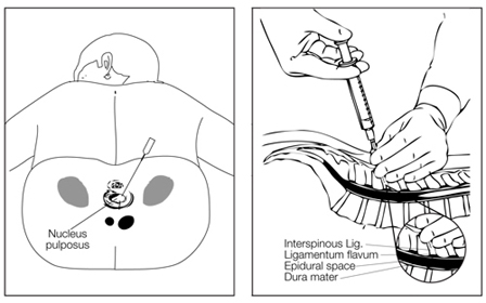 Lumbar Training Phantom CIRS 034 Training Diagram