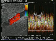 Ultrasound Blood Mimicking Fluid CIRS 046 Graph
