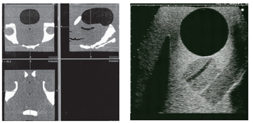 Multi-Modality Pelvic Phantom CIRS 048 Ultrasound/MRI/CT Scan Image