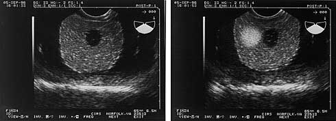 CIRS 053G Ultrasound