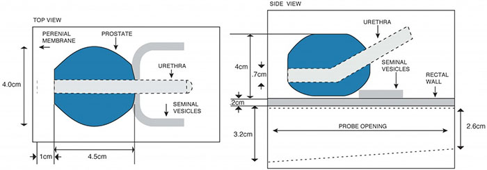 Prostate Ultrasound Training Phantom Seed Placement CIRS 053-I Diagram