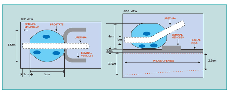 Multi-Modality Prostate Training Phantom CIRS 053-MM The ideal training device for Ultrasound, CT and MRI guided procedures Diagram