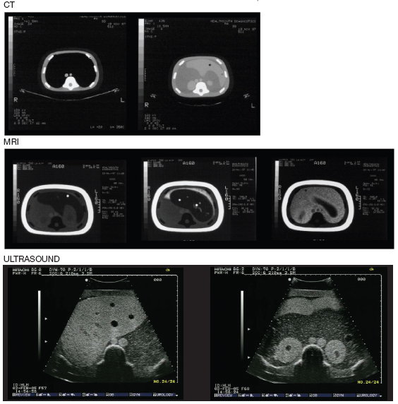 Interventional 3D Abdominal Phantom CIRS 057 Multi-modality (CT, MRI, Ultrasound) Images