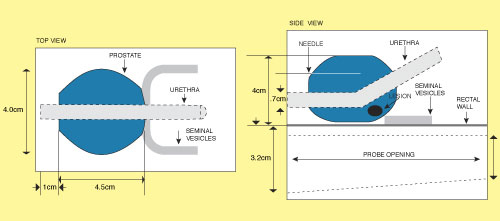 Prostate Ultrasound Demonstration Phantom CIRS 058 Diagram