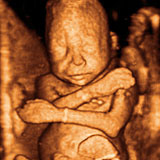 Fetal Ultrasound Training Phantom CIRS 065-20 & 065-36 20 week image
