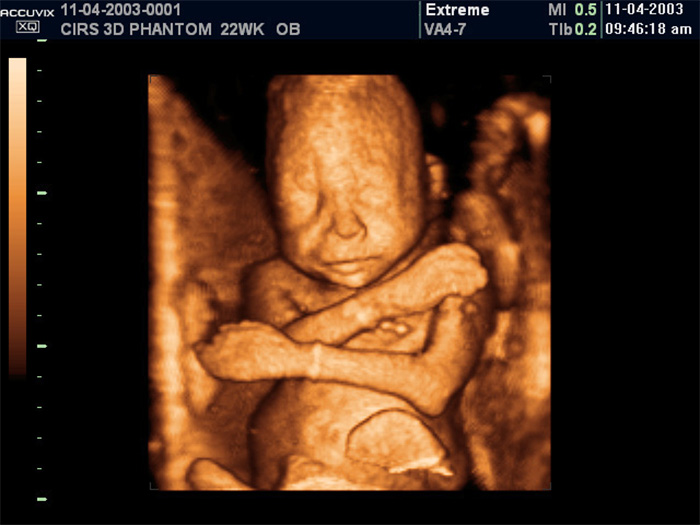 20 week ultrasound 4d 20 week ultrasound 4d