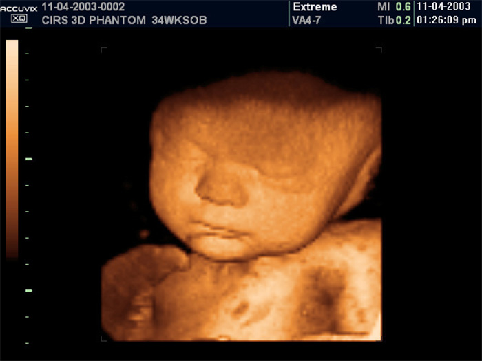 4d ultrasound pictures at 36 weeks 4d ultrasound pictures at 36 weeks