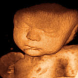 Fetal Ultrasound Training Phantom CIRS 065-20 & 065-36 36 week image