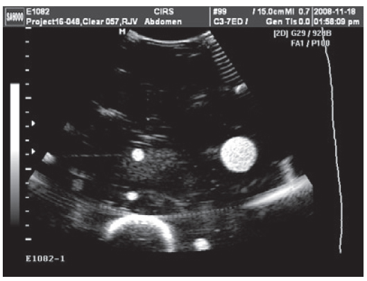 Image-Guided Abdominal Biopsy Phantom CIRS 071 Ultrasound Image