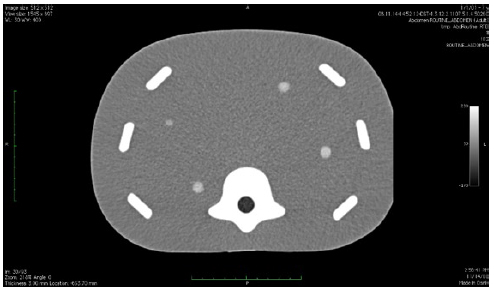 Image-Guided Abdominal Biopsy Phantom CIRS 071 CT Image