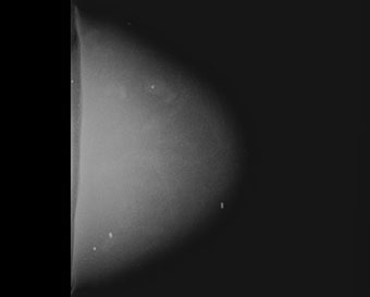 Model 073 X-Ray Mammography