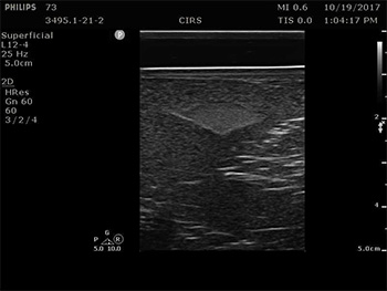 Model 073 Ultrasound - 1