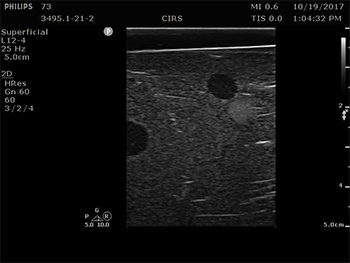 Model 073 Ultrasound - 2