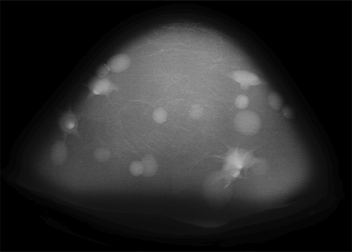 Model 073 X-Ray Mammography