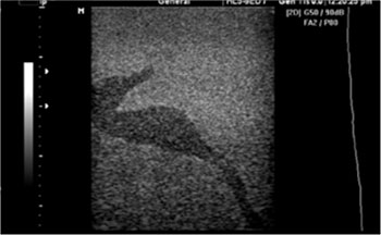 CIRS 077 - Ultrasound scan 1