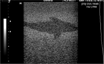 CIRS 077 - Ultrasound scan 2