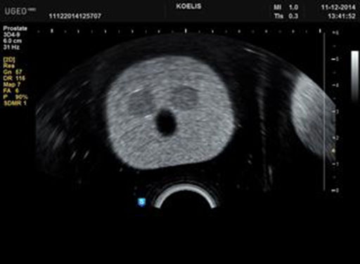 CIRS 053L Ultrasound