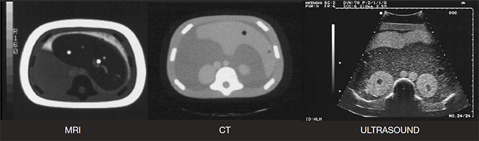 CIRS 057 CT, MRI, Ultrasound images