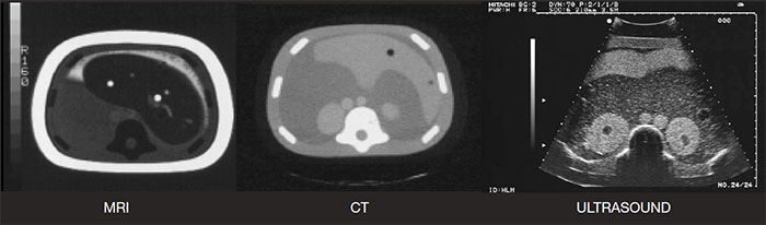 Triple Modality 3d Abdominal Phantom Cirs 057a Ct Ultrasound Mri Image Fusion Live Scanning Biopsy Training