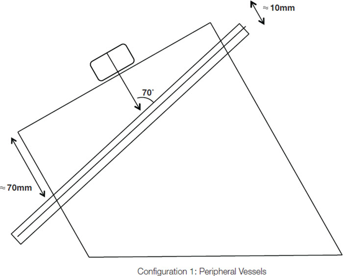 CIRS 069 - Diagram 1