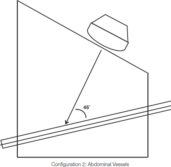 CIRS 069 - Diagram 2