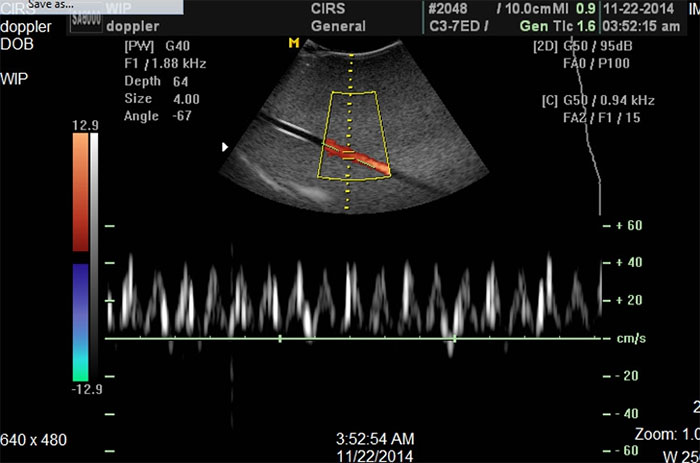 CIRS 069 - Ultrasound 1