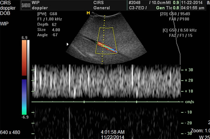 CIRS 069 - Ultrasound 2