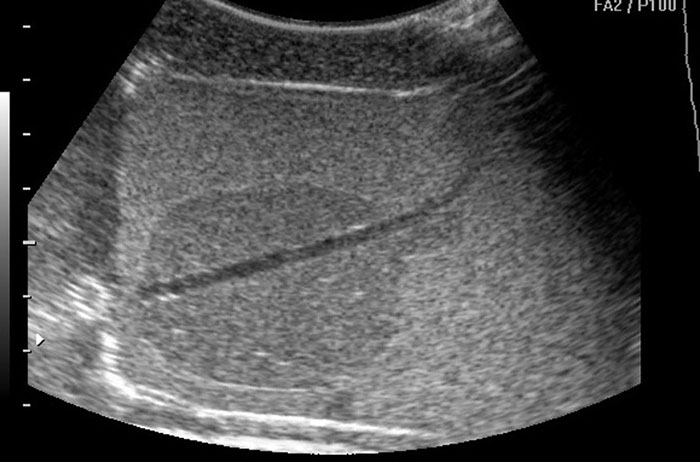 CIRS 070S & 070L Ultrasound 1