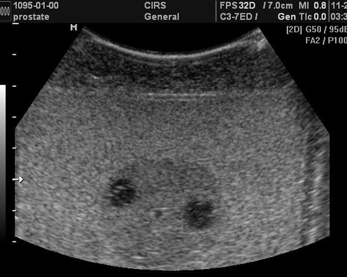 CIRS 070S & 070L Ultrasound 2