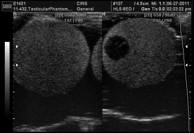 Scrotal Ultrasound Training Phantom CIRS 504 Ultrasound Image