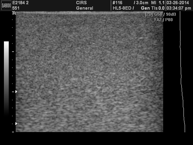 Ultrasound Scan of CIRS 551 Using Linear