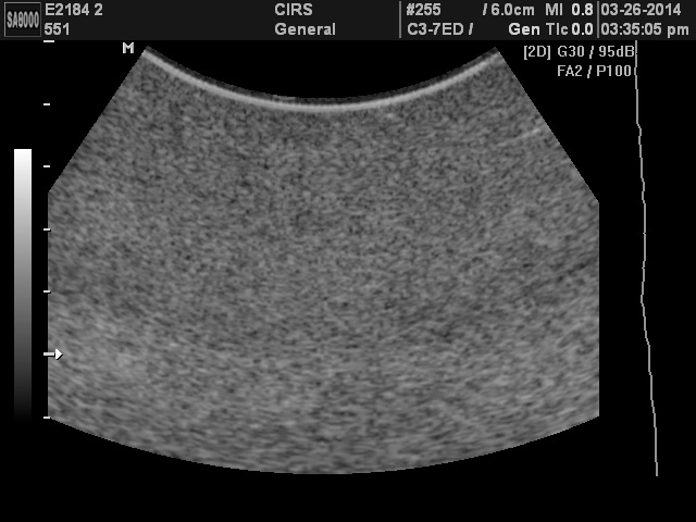 Ultrasound Scan of CIRS 551 Using Curved