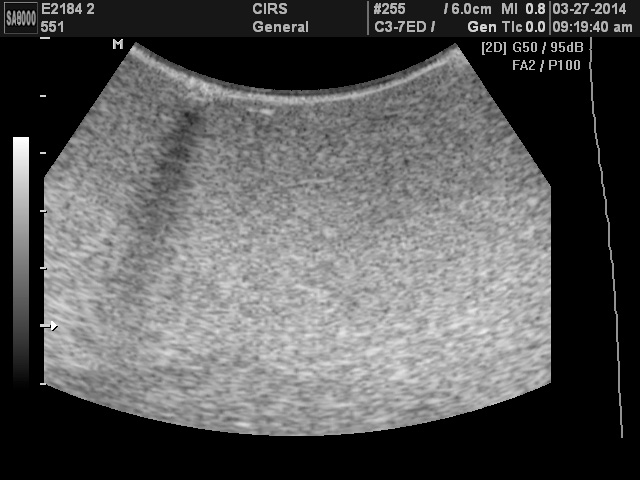 Ultrasound Scan of CIRS 551 Illustrating
