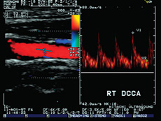 Doppler String Ultrasound Phantom CIRS 043 2