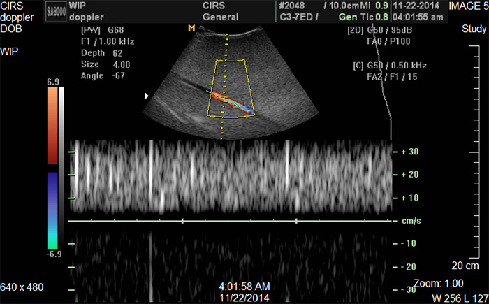 Doppler Flow Pump - CIRS 769 - ultrasound 2
