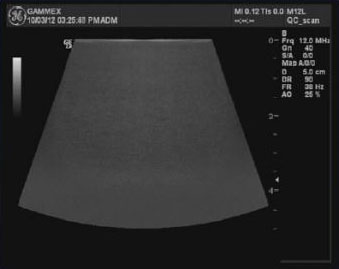 UTED phantom used with a normal transducer