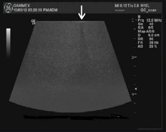 UTED phantom used with a transducer with 1 bad element