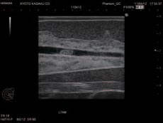 Ultrasound Scan 2