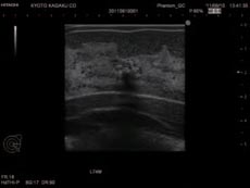 Ultrasound Scan 5