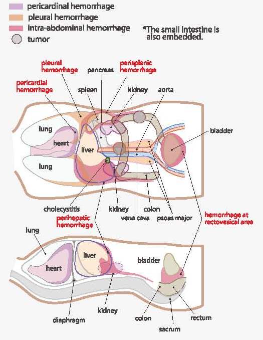 "FAST/ER FAN" Internal Organs