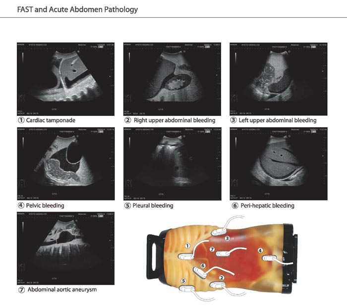 "FAST/ER FAN" Ultrasound Images