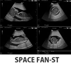 SPACEFAN-ST Ultrasound Scan Images