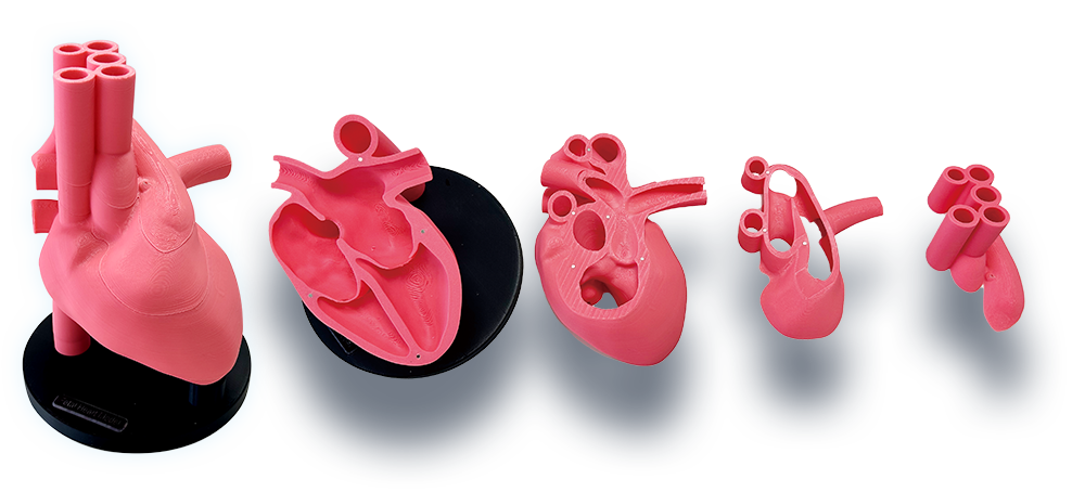SPACE FAN-ST three-times-enlarged five-piece fetal heart model