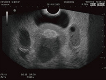 US-10 Pathological Phantom Ultrasound 2