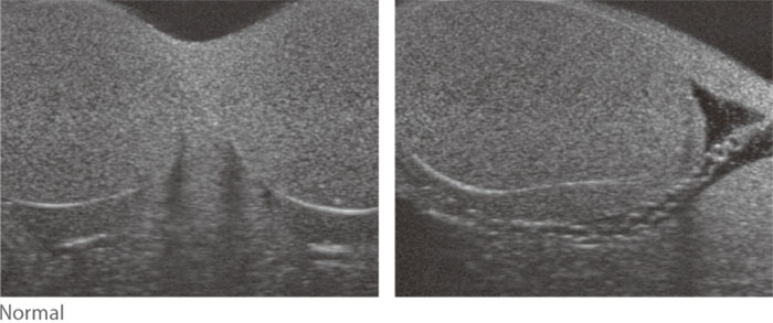 Ultrasound of Normal Scrotal Ultrasound Phantom - Kyoto Kagaku - US-11