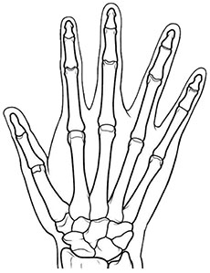 Rheumatoid Hand Phantom - US-17 - Kyoto Kagaku