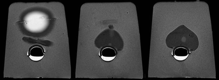 Multi-Modality Prostate Phantom - MRI Images